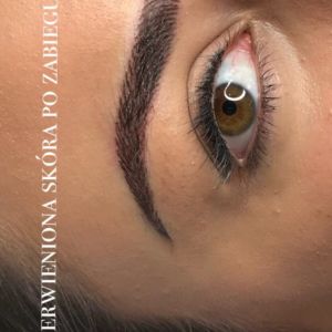 Zaczerwienienie skóry widoczne bezpośrednio po wykonaniu zabiegu Jak wyglądają brwi bezpośrednio po zabiegu makijażu permanentnego